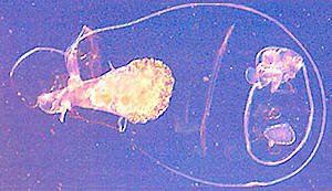 Rdertier Asplanchna priodonta